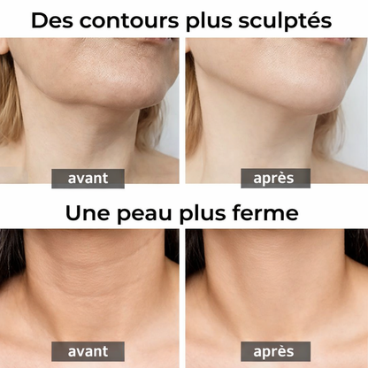 Sculpta Skin - Appareil Anti-Rides