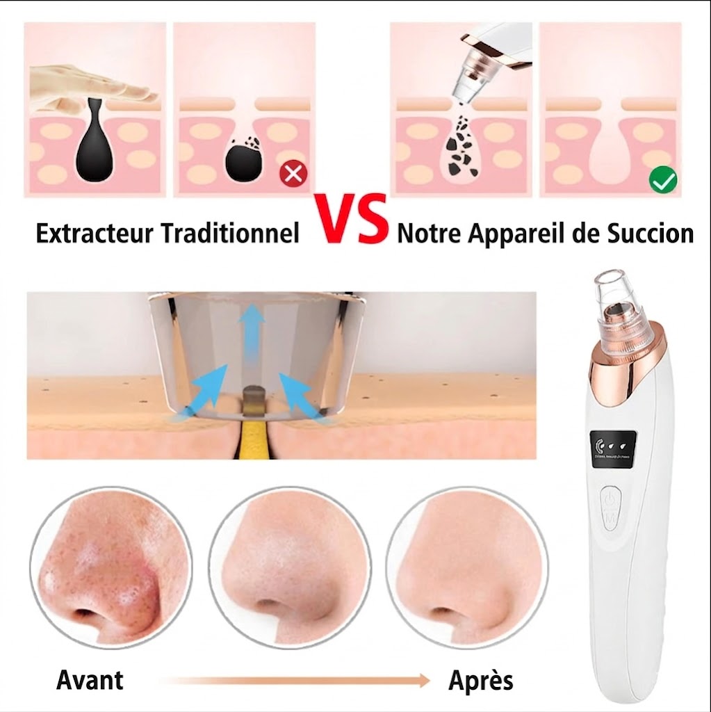 Extracteur de Points Noirs