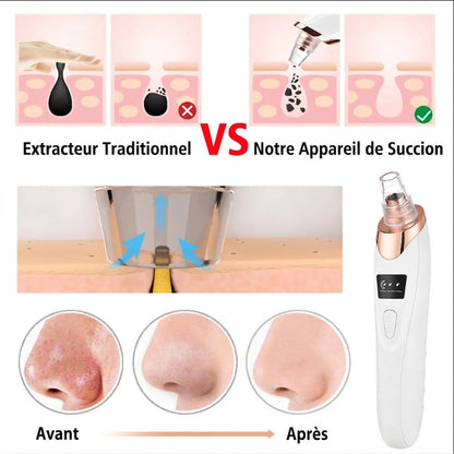 Extracteur de Points Noirs